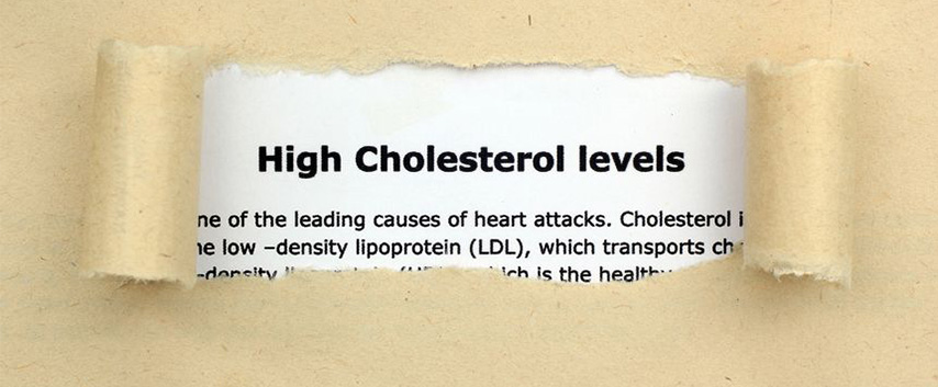 cholesterol-symptoms